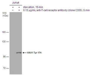 Anti-VAV1 (phospho Tyr174) antibody used in Western Blot (WB). GTX132787